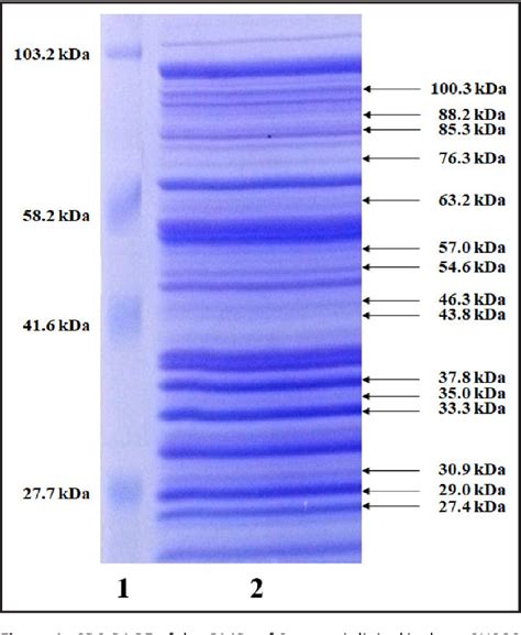 shigella sonnei biochemical tests|Outer membrane proteins analysis of Shigella sonnei .